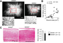 Phagocytosis of Wnt inhibitor SFRP4 by late wound macrophages drives chronic Wnt activity for fibrotic skin healing – Science Advances