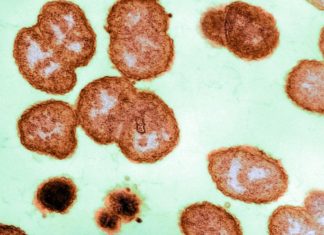 As the Pandemic Wanes, Sexually Transmitted Infections Are Likely to Rise – Scientific American