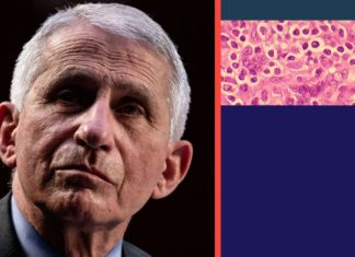 Fauci: Aiming for a “home run” with AIDS research – Yahoo News