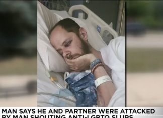 Thug shouting slurs fractures gay man’s skull as his partner screams for help – LGBTQ Nation