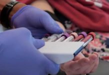 LGBTQ+ groups hopeful research effort leads to expanded blood donor eligibility – California News Times