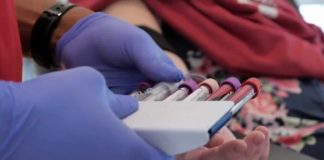 LGBTQ+ groups hopeful research effort leads to expanded blood donor eligibility – California News Times