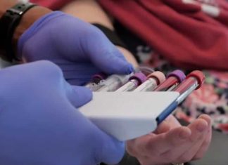 LGBTQ+ groups hopeful research effort leads to expanded blood donor eligibility – California News Times