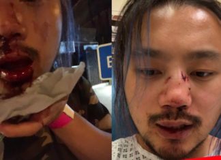Man who bravely defended his gay friend beaten in hate crime – PinkNews