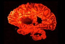 Podcast: Understanding a Terrorist’s Brain – Undark Magazine – Undark Magazine