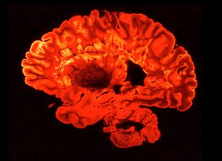 Podcast: Understanding a Terrorist’s Brain – Undark Magazine – Undark Magazine