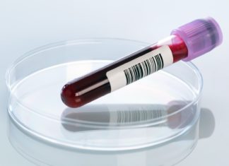 Article: Should Deferrals Be Lifted for Gay Blood Donors? – WebMD