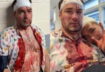 Couple beaten with glass bottles in brutal homophobic attack in Birmingham’s Gay Village – Yahoo Eurosport UK