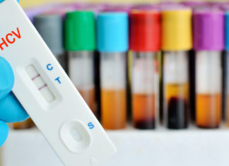 Gay and Bisexual Men Recently Treated for Hep C at High Risk for Reinfection – POZ