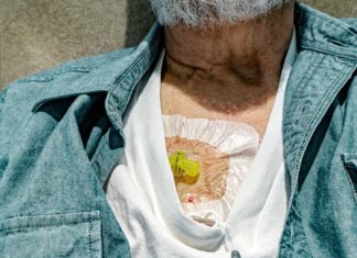 How to Sleep with a Chemo Port: Suggestions and Precautions – Healthline