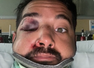 Man gets knocked unconscious & beaten by two complete strangers in park for being gay – LGBTQ Nation