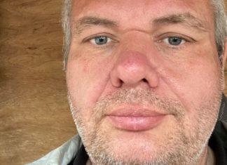 Man Knifed And Boyfriend Beaten In Homophobic Attack In Gay Village – Todayuknews – Todayuknews
