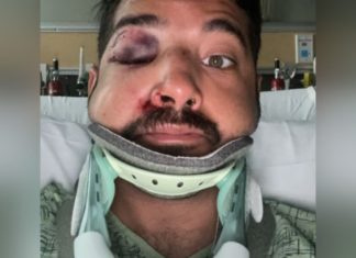 Police investigating hate crime attack after gay man beaten unconscious in San Diego park – Metro Weekly