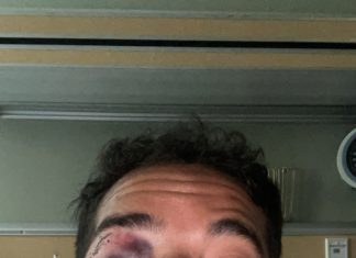 San Diego Police Seek Suspects Who Beat Man in Anti-Gay Hate Crime – NBC San Diego
