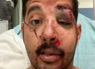 Two men knock gay man unconscious in violent hate crime: ‘You never expect it to happen to you’ – Yahoo Eurosport UK