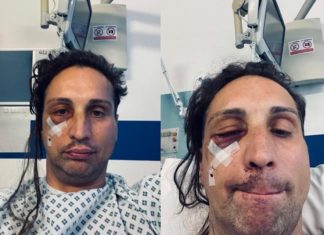 Gay man afraid to leave his house after being hit with hammer in brutal ‘homophobic hate crime’ – Yahoo Eurosport UK