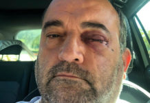 Gay man rushed to hospital to save his sight after becoming latest LGBT+ person attacked in Birmingham – PinkNews