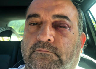 Gay man rushed to hospital to save his sight after becoming latest LGBT+ person attacked in Birmingham – PinkNews
