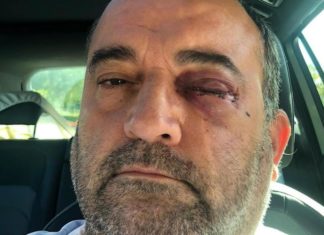 Gay man rushed to hospital to save his sight after becoming latest LGBT+ person attacked in Birmingham – Yahoo News UK