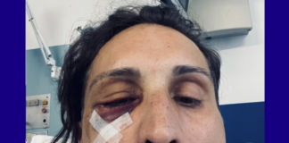 Gay man was nearly killed when thug pounded him with hammer in vicious mob attack – LGBTQ Nation