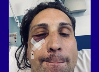 Gay man was nearly killed when thug pounded him with hammer in vicious mob attack – LGBTQ Nation