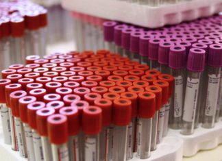 The UK is dropping a ‘discriminatory’ sexual health barrier to blood donation – Euronews