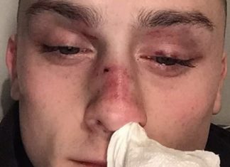 Gay man attacked with hammer while walking down street with boyfriend – Mirror.co.uk