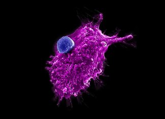 UCLA scientists make strides toward an ‘off-the-shelf’ immune cell therapy for cancer | UCLA – UCLA Newsroom