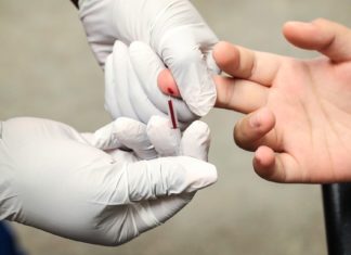 Because of Covid, 2020 was a ‘lost year’ in the fight against HIV, report suggests – NBC News