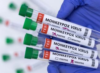 CDC identifies nine suspected monkeypox cases in U.S. amid signs of local spread – The Washington Post