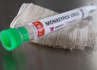 Could monkeypox bring a new wave of homophobia? – Slate