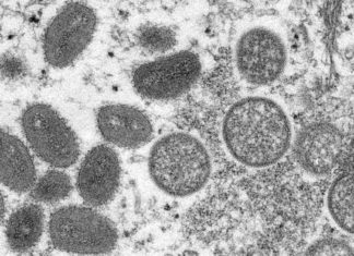 Gay Men Need a Specific Warning About Monkeypox – The Atlantic