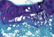 Monkeypox Is Not A STD Or A ‘Gay Disease’ – Here’s Why That’s Important – IFLScience