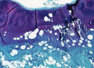 Monkeypox Is Not A STD Or A ‘Gay Disease’ – Here’s Why That’s Important – IFLScience
