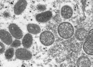 2 additional cases of monkeypox confirmed in Massachusetts, state health officials say – WCVB Boston