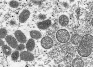 As monkeypox cases grow, so do fears of gay blame and stigma once again – The Seattle Times