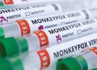 Bay Area sees more monkeypox cases – Bay Area Reporter, America’s highest circulation LGBT newspaper