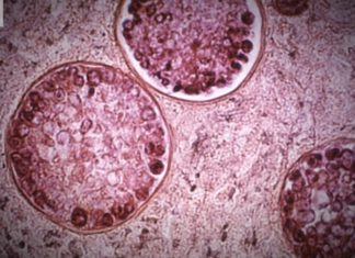 CDC says gay and bi men in Florida need the meningococcal vaccine, to keep them safe in ‘worst’ outbreak in US history – Local News 8 – LocalNews8.com