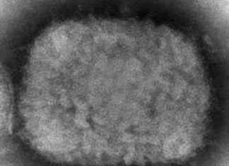 EU regulator considers clearing smallpox shot for monkeypox – WDIV ClickOnDetroit