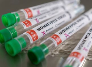 Health officials scramble to ramp up monkeypox testing amid increasing demand – New York Post