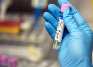 Homophobic misinformation is making it harder to contain the spread of monkeypox – MIT Technology Review
