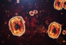 How the rhetoric around monkeypox recalls biases in early HIV news coverage – Salon