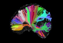 Mental Illness Is Not in Your Head – Boston Review