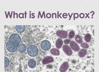 Monkeypox and gay men: Here’s what we know – Q Voice News