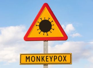Monkeypox Is Not a Gay Disease – The Nation