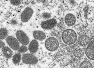 Monkeypox is recapitulating the stigma and structural inequity of HIV, Ebola, and other diseases – STAT