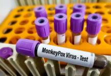 Monkeypox jab be given to at-risk gay, bisexual men, says UK report – Business Insider India
