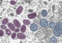 More than a million monkeypox vaccines are on their way in the US – Popular Science