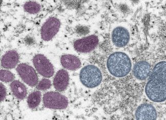 More than a million monkeypox vaccines are on their way in the US – Popular Science
