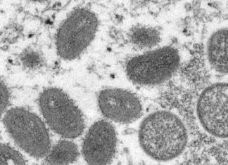 Number of monkeypox patients are gay and bi-sexual men – msnNOW